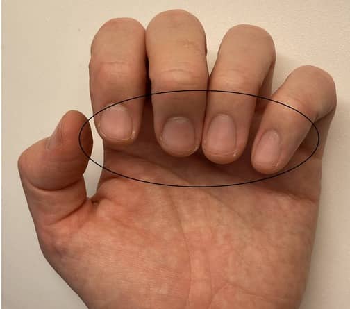 Bild som visar vÃ¤nster hand med kortar naglar